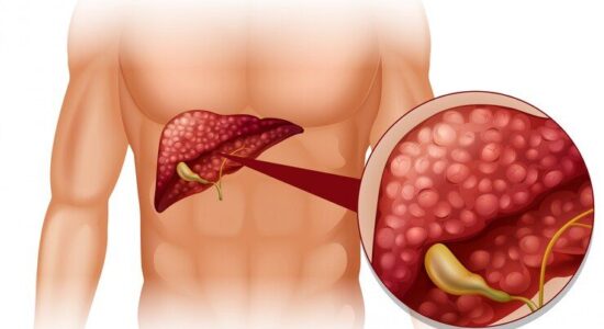 The Guardians of the Liver