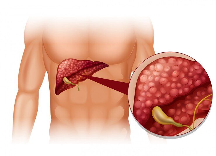 The Guardians of the Liver